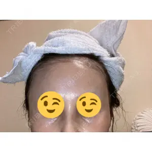 口コミ