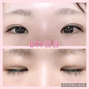 AI Beauty Clinic （エーアイ美容クリニック）口コミ