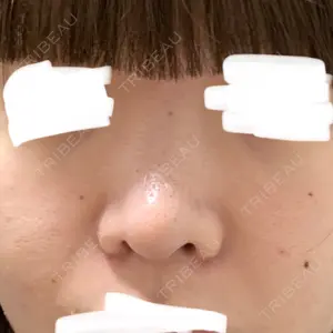 MIL CLINIC OSAKA口コミ