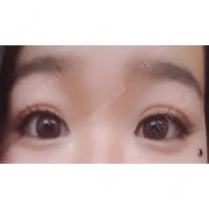 口コミ