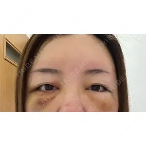 X CLINIC X CLINIC 銀座院口コミ
