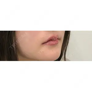 APスキンクリニック銀座口コミ