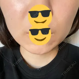 口コミ