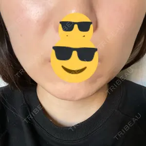 口コミ