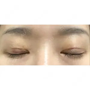 TAクリニック 札幌TAクリニック口コミ