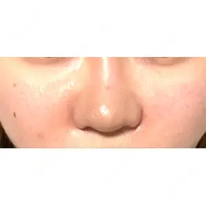 L‘amour clinic Tokyo【ラムールクリニック東京】口コミ