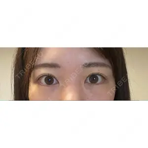 X CLINIC X CLINIC 銀座院口コミ