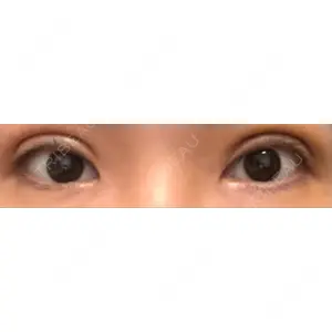 東京イセアクリニック口コミ