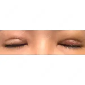 東京イセアクリニック口コミ