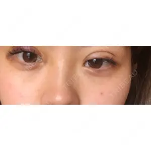 湘南美容クリニック 湘南美容クリニック 柏院口コミ