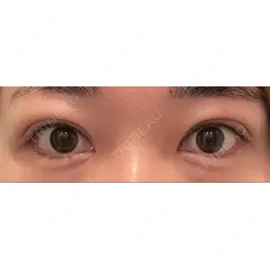 湘南美容クリニック 湘南美容クリニック 池袋東口院口コミ