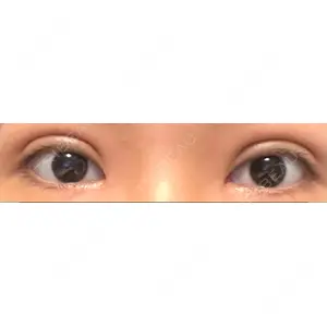 東京イセアクリニック口コミ