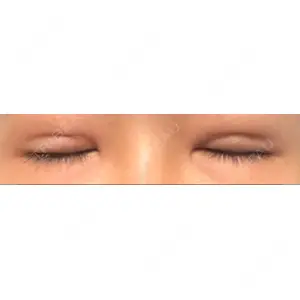 東京イセアクリニック口コミ