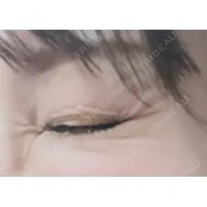 フィラークリニック フィラークリニック 町田院口コミ