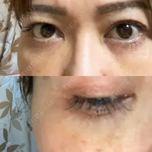 AI Beauty Clinic （エーアイ美容クリニック）口コミ