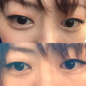 X CLINIC X CLINIC 銀座院口コミ