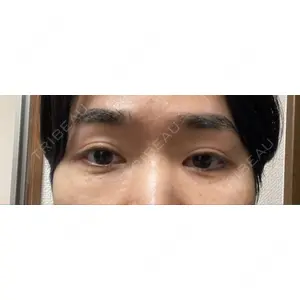 東京イセアクリニック口コミ