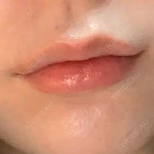 フィラークリニック フィラークリニック 町田院口コミ