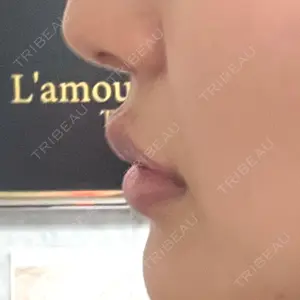 L‘amour clinic Tokyo【ラムールクリニック東京】口コミ