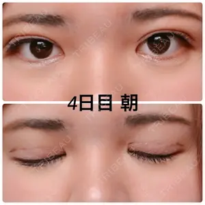 口コミ