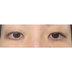 東京イセアクリニック口コミ