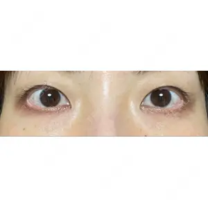 東京イセアクリニック口コミ