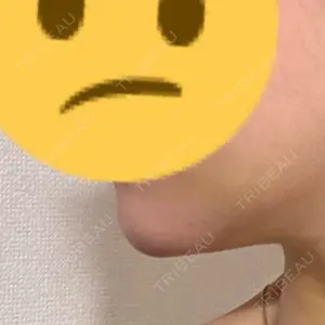白金ビークリニック 本院口コミ