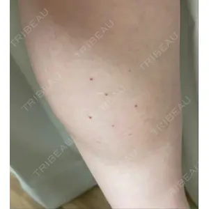 DMTC美容皮膚科 DMTC美容皮膚科 渋谷院口コミ