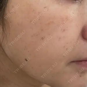 神楽坂美容クリニック タテバ芍薬口コミ
