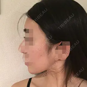 クッキー整形外科の