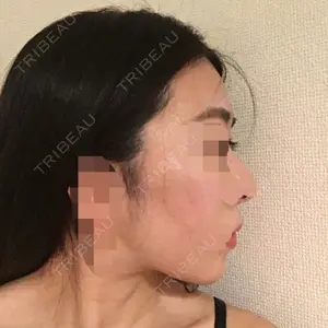 クッキー整形外科の