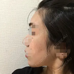 クッキー整形外科の