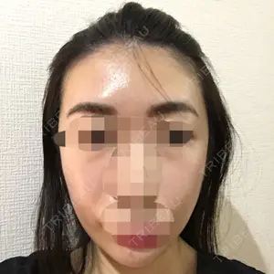 クッキー整形外科の