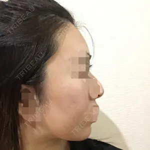 クッキー整形外科の