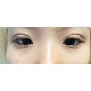 湘南美容クリニック 湘南美容クリニック 新宿南口院口コミ