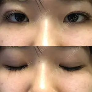 口コミ