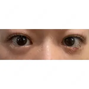 APOLLO BEAUTY CLINIC口コミ