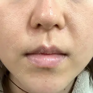 LUNA BEAUTY CLINIC ブリリアスキンクリニック 新宿院口コミ