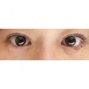 APOLLO BEAUTY CLINIC口コミ