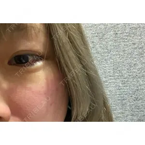 LUNA BEAUTY CLINIC ブリリアスキンクリニック 新宿院口コミ