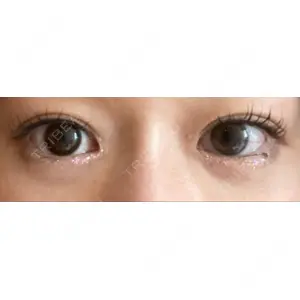 APOLLO BEAUTY CLINIC口コミ