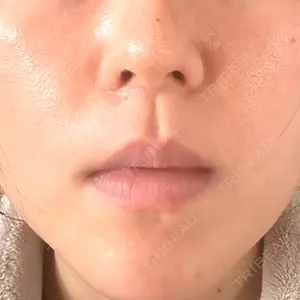 LUNA BEAUTY CLINIC ブリリアスキンクリニック 新宿院口コミ