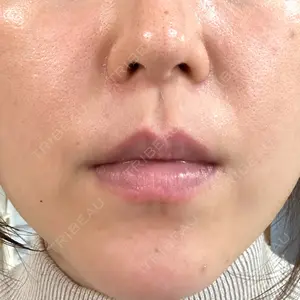 LUNA BEAUTY CLINIC ブリリアスキンクリニック 新宿院口コミ