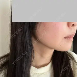 TAクリニック 札幌TAクリニック口コミ