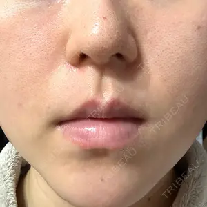 LUNA BEAUTY CLINIC ブリリアスキンクリニック 新宿院口コミ