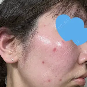 まゆりなclinic 名古屋栄口コミ