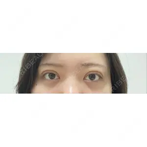 湘南美容クリニック 湘南美容クリニック 池袋東口院口コミ
