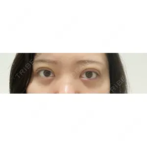 湘南美容クリニック 湘南美容クリニック 池袋東口院口コミ