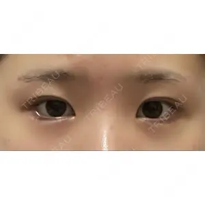 プロミス整形外科口コミ