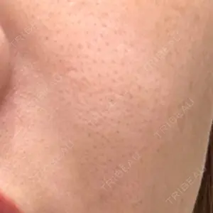 L‘amour clinic Tokyo【ラムールクリニック東京】口コミ